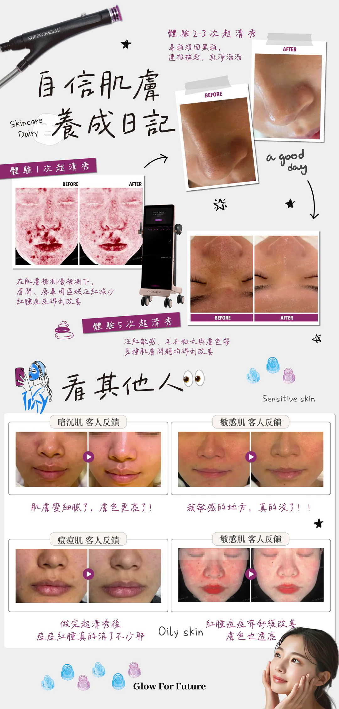 自信肌膚養成日記 — 體驗超清秀前後對比紀錄